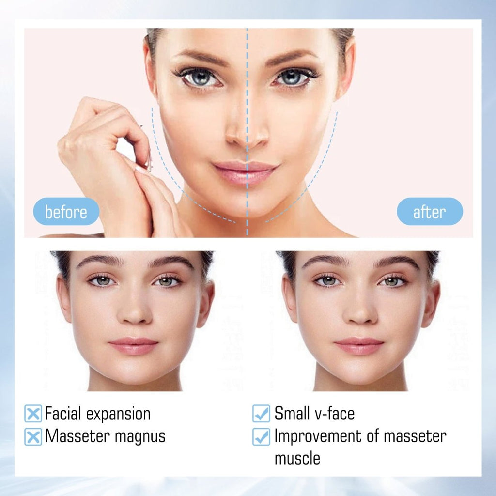 V Shape Face Lifting Mask – Collagen Firming, Double Chin Tightening, Jawline Contour Slimming Mask - Upkinify Inc. All Rights Reserved
